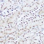 SART1 Antibody in Immunohistochemistry (Paraffin) (IHC (P))