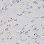 TMC1 Antibody in Immunohistochemistry (Paraffin) (IHC (P))