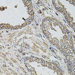 TMC1 Antibody in Immunohistochemistry (Paraffin) (IHC (P))