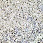 TMC1 Antibody in Immunohistochemistry (Paraffin) (IHC (P))