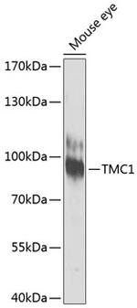 TMC1 Antibody in Western Blot (WB)