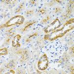 AIFM3 Antibody in Immunohistochemistry (Paraffin) (IHC (P))