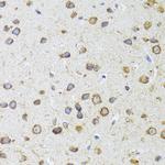 AIFM3 Antibody in Immunohistochemistry (Paraffin) (IHC (P))