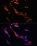 beta-3 Adrenergic Receptor Antibody in Immunocytochemistry (ICC/IF)