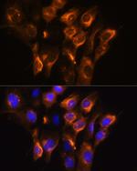 beta-3 Adrenergic Receptor Antibody in Immunocytochemistry (ICC/IF)