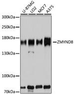 ZMYND8 Antibody in Western Blot (WB)