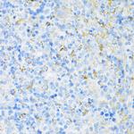 VAMP1 Antibody in Immunohistochemistry (Paraffin) (IHC (P))