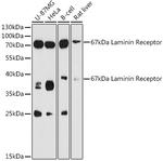 RPSA Antibody in Western Blot (WB)