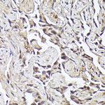 METTL4 Antibody in Immunohistochemistry (Paraffin) (IHC (P))