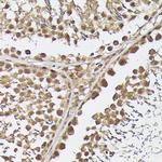 METTL4 Antibody in Immunohistochemistry (Paraffin) (IHC (P))