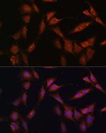 PFKFB2 Antibody in Immunocytochemistry (ICC/IF)