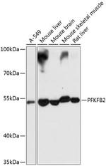 PFKFB2 Antibody in Western Blot (WB)