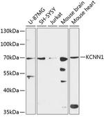 KCNN1 Antibody in Western Blot (WB)