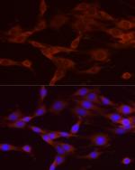 NUMB Antibody in Immunocytochemistry (ICC/IF)