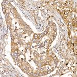 NUMB Antibody in Immunohistochemistry (Paraffin) (IHC (P))