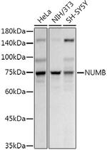 NUMB Antibody in Western Blot (WB)