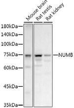 NUMB Antibody in Western Blot (WB)