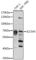 SLC5A5 Antibody in Western Blot (WB)