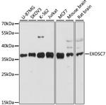 EXOSC7 Antibody in Western Blot (WB)