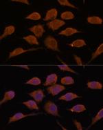 USP19 Antibody in Immunocytochemistry (ICC/IF)