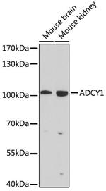 ADCY1 Antibody in Western Blot (WB)