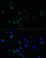 NOXA Antibody in Immunocytochemistry (ICC/IF)