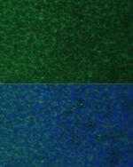 NOXA Antibody in Immunocytochemistry (ICC/IF)