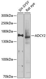 ADCY2 Antibody in Western Blot (WB)