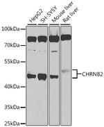 CHRNB2 Antibody in Western Blot (WB)