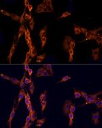 EPS15 Antibody in Immunocytochemistry (ICC/IF)