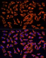 EPS15 Antibody in Immunocytochemistry (ICC/IF)