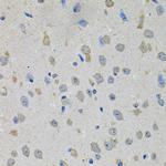 PTK7 Antibody in Immunohistochemistry (Paraffin) (IHC (P))