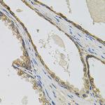 PTK7 Antibody in Immunohistochemistry (Paraffin) (IHC (P))