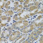 PTK7 Antibody in Immunohistochemistry (Paraffin) (IHC (P))