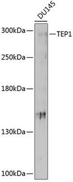 TEP1 Antibody in Western Blot (WB)