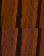 FBP2 Antibody in Immunohistochemistry (Paraffin) (IHC (P))