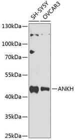 ANKH Antibody in Western Blot (WB)