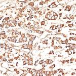 KIR3DS1 Antibody in Immunohistochemistry (Paraffin) (IHC (P))