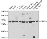 KIR3DS1 Antibody in Western Blot (WB)