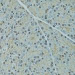 SERPINF2 Antibody in Immunohistochemistry (Paraffin) (IHC (P))