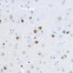 RPP25 Antibody in Immunohistochemistry (Paraffin) (IHC (P))