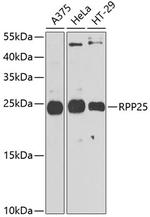 RPP25 Antibody in Western Blot (WB)