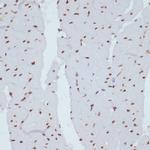 Phospho-Chk1 (Ser280) Antibody in Immunohistochemistry (Paraffin) (IHC (P))