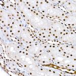 Phospho-CREB (Ser133) Antibody in Immunohistochemistry (Paraffin) (IHC (P))