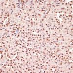 Phospho-ATF (Thr71) Antibody in Immunohistochemistry (Paraffin) (IHC (P))