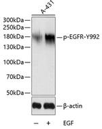 Phospho-EGFR (Tyr992) Antibody in Western Blot (WB)