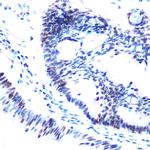 Phospho-SMC1 (Ser957) Antibody in Immunohistochemistry (Paraffin) (IHC (P))