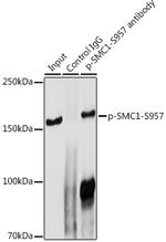 Phospho-SMC1 (Ser957) Antibody in Immunoprecipitation (IP)