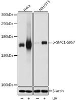 Phospho-SMC1 (Ser957) Antibody in Western Blot (WB)