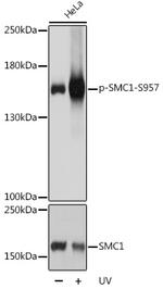 Phospho-SMC1 (Ser957) Antibody in Western Blot (WB)